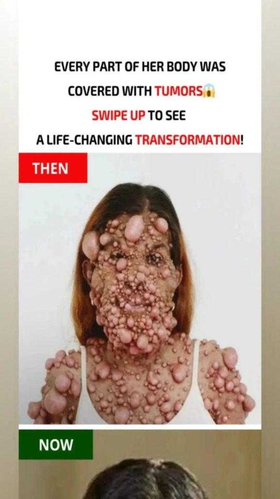 Charmaine’s Journey from Struggle to Strength