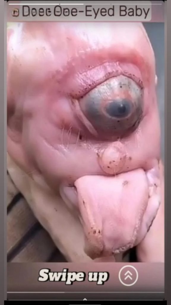 A Family’s Journey with Their Rare and Beautiful Baby