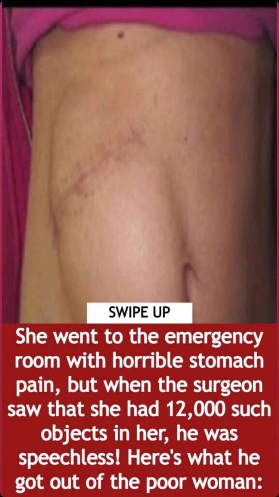 She went to the emergency room with a horrible stomach pain Read More