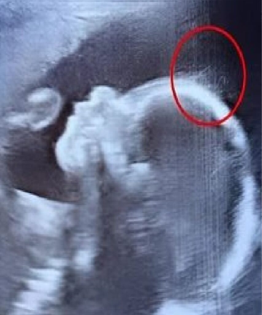 Even the doctors were stunned by what appeared on the ultrasound screen